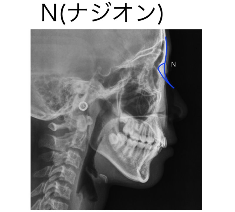 セファロ分析の目的 | 氏井矯正歯科クリニックの豆知識